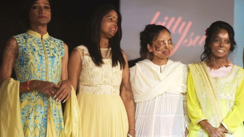Inde: des victimes d'attaques à l'acide sur le podium d'un défilé haute couture 